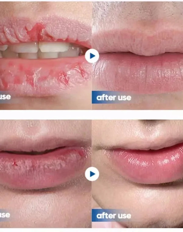 Men Lip Balm Moisturizing Hydration Fading Lip Lines Anti-Cracking Remove Dead Skin Refreshing And Not Greasy Exquisite Lip Care