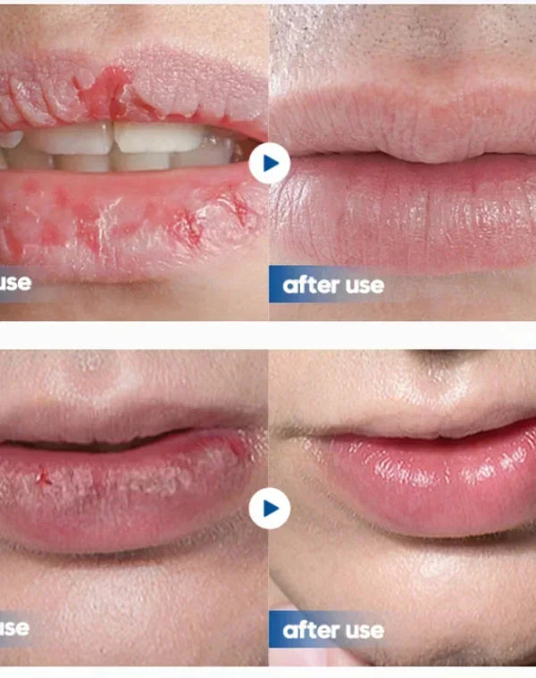Men Lip Balm Moisturizing Hydration Fading Lip Lines Anti-Cracking Remove Dead Skin Refreshing And Not Greasy Exquisite Lip Care