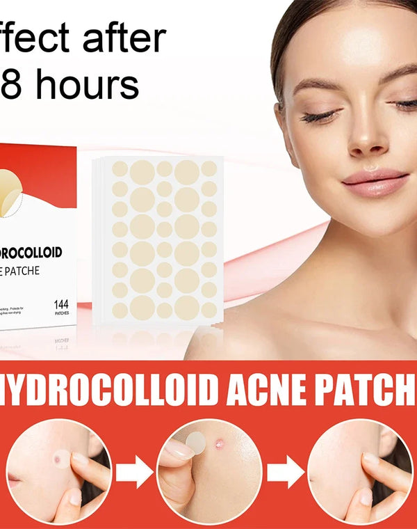 144pcs/set Face Skin Care Acne Pimple Patch 2 Sizes Invisible Professional Healing Absorbing Spot Sticker Covering for Men Women