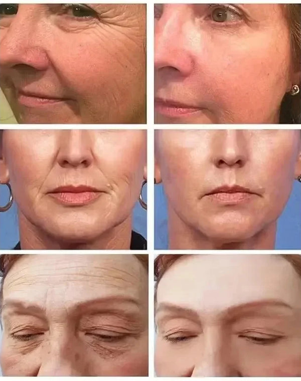 Dragon Blood Fast Wrinkle Remove Face Serum Placenta Royal Anti-Aging Firming Lifting Whitening Moisturizing Skin Care Cosmetics